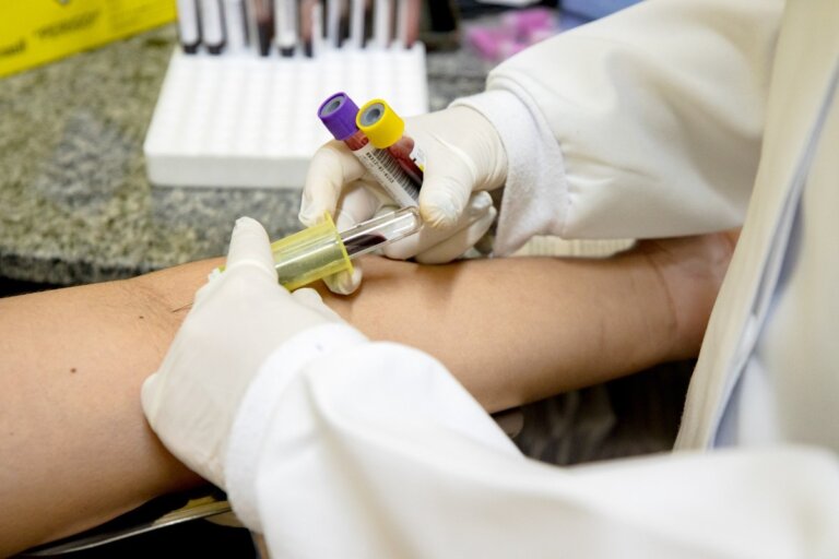 Manaus inicia oferta de novo teste para diagnóstico de tuberculose latente;  veja onde fazer |  amazonas