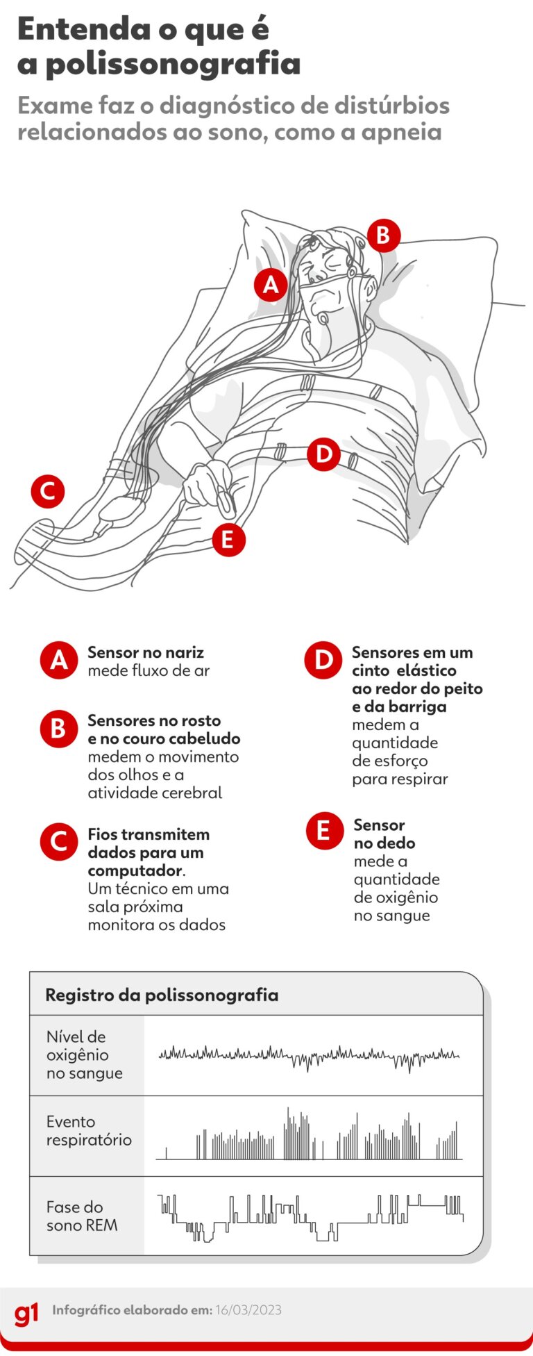 Polissonografia: mais de 12 mil brasileiros aguardam na fila para fazer o ‘exame do sono’