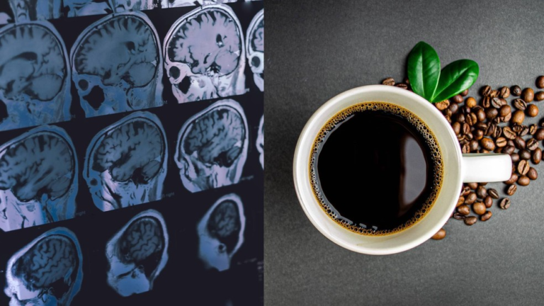 Café pode reduzir risco de demência em até 20%, diz estudo